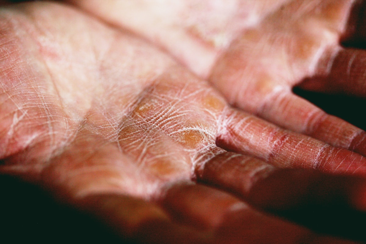 Textura de pele hidratada com emolientes